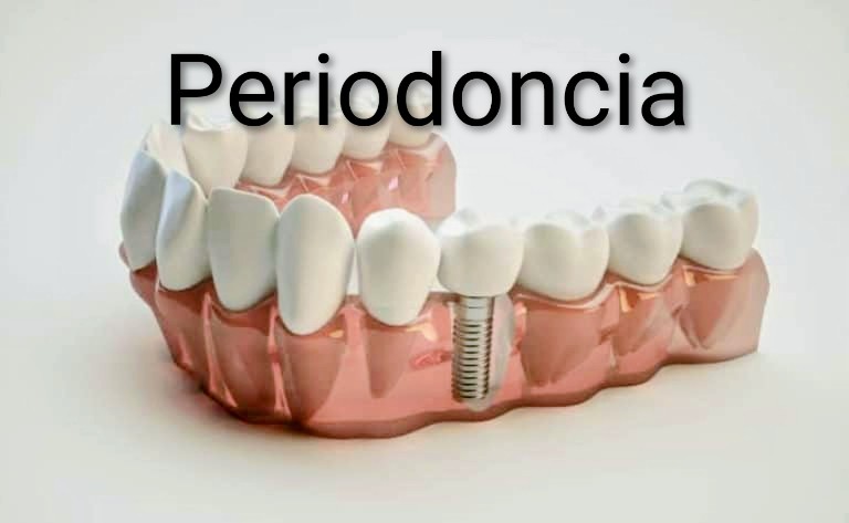 Diseño de Sonrisa Digital ✓